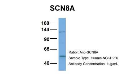 Western Blot: Nav1.6 Antibody [NBP2-84176]