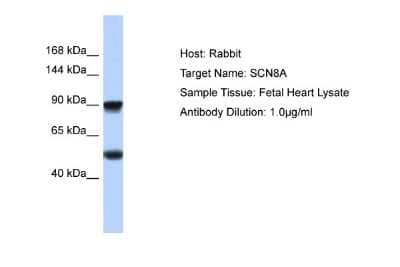 Western Blot: Nav1.6 Antibody [NBP2-84177]