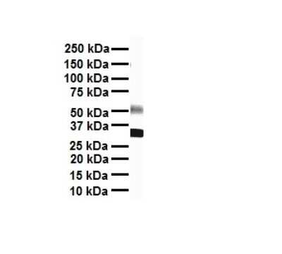 Western Blot: Nav1.6 Antibody [NBP2-84177]