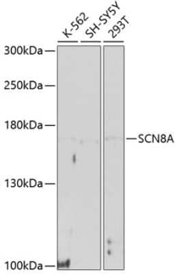 Western Blot: Nav1.6 AntibodyBSA Free [NBP3-03464]