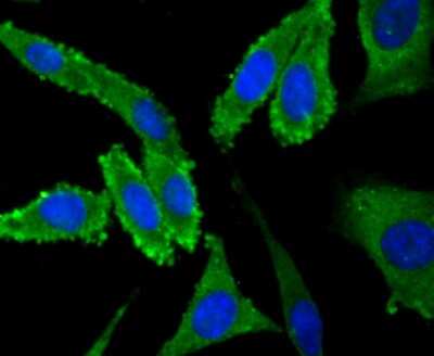 Immunocytochemistry/ Immunofluorescence: Nav1.7 Antibody [NBP2-75581]