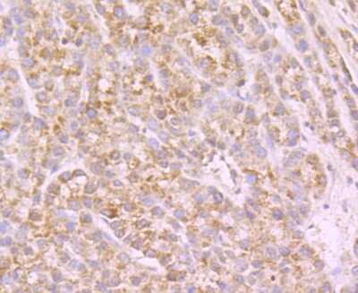 Immunohistochemistry-Paraffin: Nav1.7 Antibody [NBP2-75581]