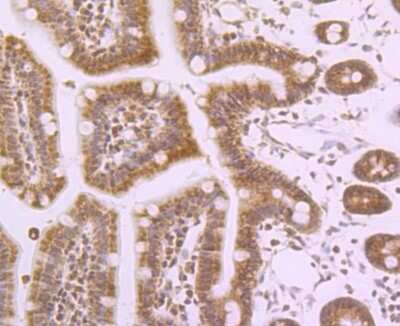 Immunohistochemistry-Paraffin: Nav1.7 Antibody [NBP2-75581]