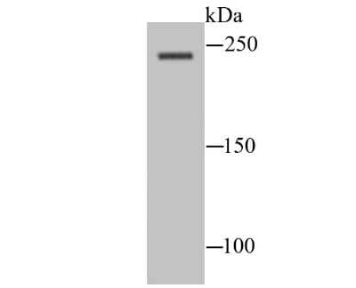 Western Blot: Nav1.8 Antibody [NBP2-75584]