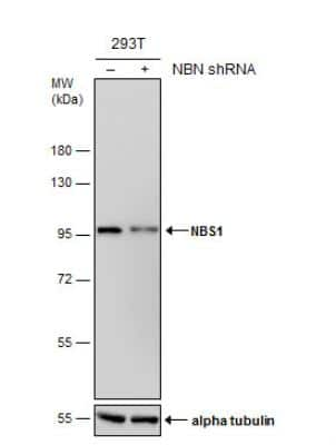 Knockdown Validated: Nbs1 Antibody (1D7) [NB100-221]