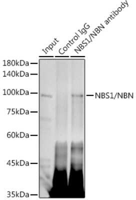 Immunoprecipitation: Nbs1 Antibody (4G4R1) [NBP3-16355]
