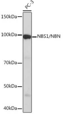 Western Blot: Nbs1 Antibody (4G4R1) [NBP3-16355]