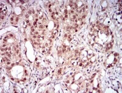 Immunohistochemistry-Paraffin: Nbs1 Antibody (7E4A2) - Azide and BSA Free [NBP2-80867]