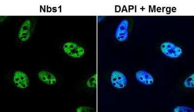 Immunocytochemistry/ Immunofluorescence: Nbs1 Antibody [NB100-143]