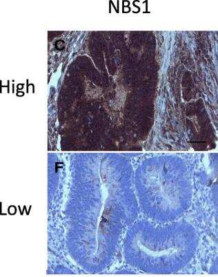 Immunohistochemistry: Nbs1 Antibody - BSA Free [NBP1-06609]