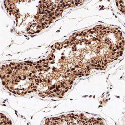 Immunohistochemistry-Paraffin: Nbs1 Antibody [NB100-143]