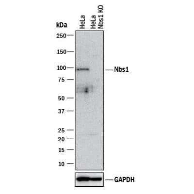 Knockout Validated: Nbs1 Antibody [NB100-143]