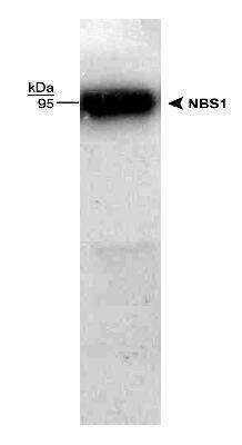 Western Blot: Nbs1 Antibody [NB100-143]