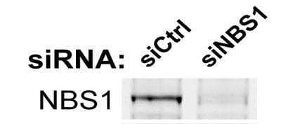 Western Blot: Nbs1 Antibody [NB100-143]