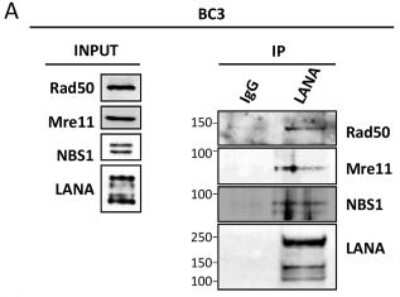Western Blot: Nbs1 Antibody [NB100-143]