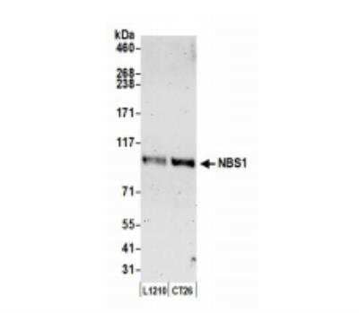 Western Blot: Nbs1 Antibody [NB100-60648]