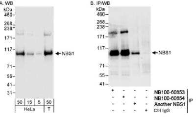 Western Blot: Nbs1 Antibody [NB100-60654]