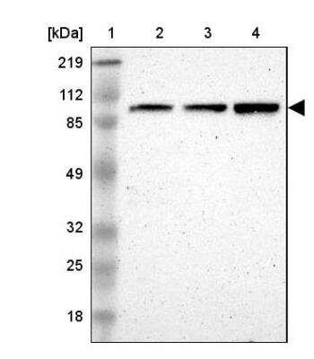 Western Blot: Nbs1 Antibody [NBP2-54661]