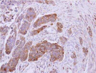 Immunohistochemistry-Paraffin: Ndufs1 Antibody [NBP1-31142]