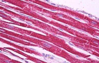Immunohistochemistry-Paraffin: Ndufs1 Antibody [NBP1-52060]