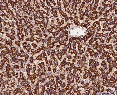 Immunohistochemistry-Paraffin: Ndufs1 Antibody [NBP3-12701]