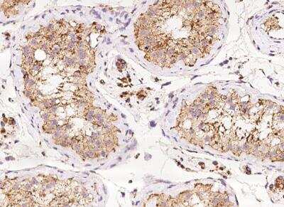Immunohistochemistry-Paraffin: Ndufs1 Antibody [NBP3-12701]