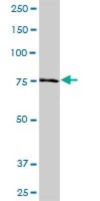 Western Blot: Ndufs1 Antibody [H00004719-B01P]