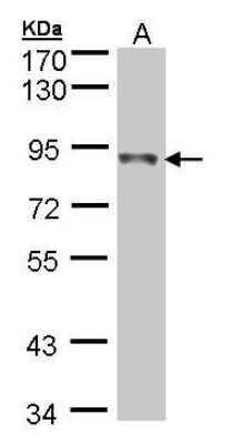 Western Blot: Ndufs1 Antibody [NBP1-31142]