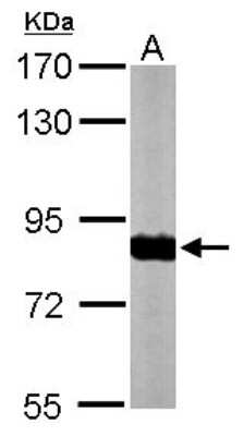 Western Blot: Ndufs1 Antibody [NBP1-31142]