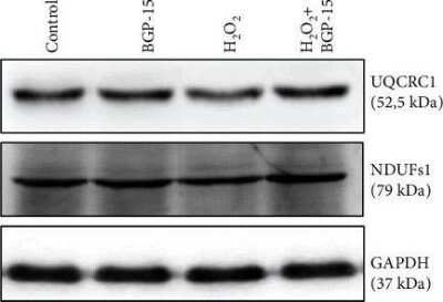 Western Blot: Ndufs1 Antibody [NBP1-31142]