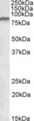 Western Blot: Ndufs1 Antibody [NBP1-52060]