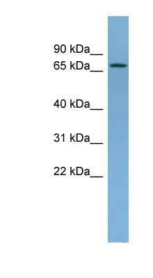 Western Blot: Ndufs1 Antibody [NBP1-56520]
