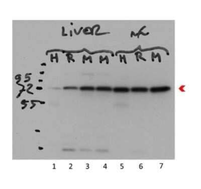 Western Blot: Ndufs1 Antibody [NBP1-56520]