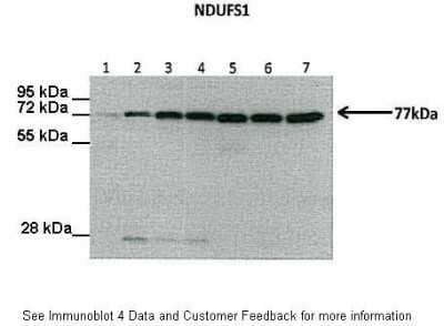 Western Blot: Ndufs1 Antibody [NBP1-56520]