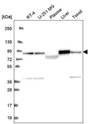 Western Blot: Ndufs1 Antibody [NBP2-56504]