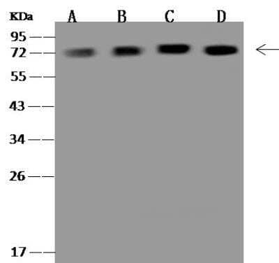 Western Blot: Ndufs1 Antibody [NBP3-12701]