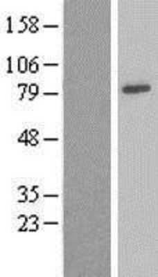 Western Blot: Ndufs1 Overexpression Lysate [NBL1-13560]