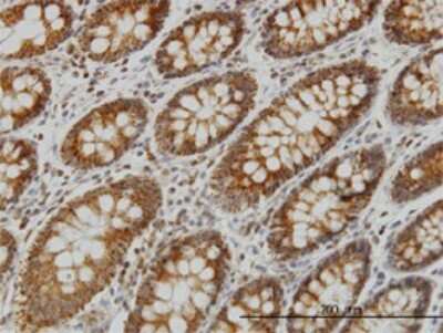 Immunohistochemistry-Paraffin: Ndufs4 Antibody (1A1) [H00004724-M01]