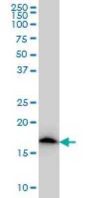 Western Blot: Ndufs4 Antibody (1A1) [H00004724-M01]