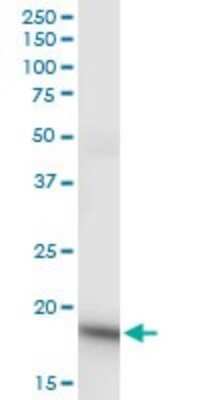 Western Blot: Ndufs4 Antibody (3F11) [H00004724-M03]