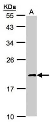 Western Blot: Ndufs4 Antibody [NBP1-31465]