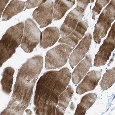 Immunohistochemistry-Paraffin: Nebulin Antibody [NBP1-87752]