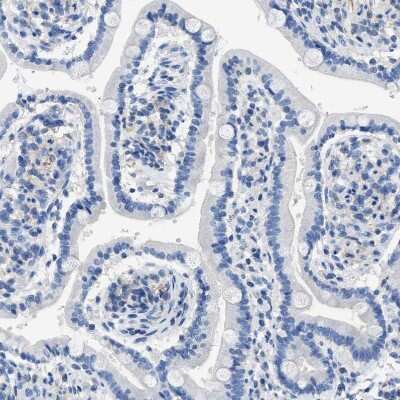 Immunohistochemistry-Paraffin: Nebulin Antibody [NBP1-87752]