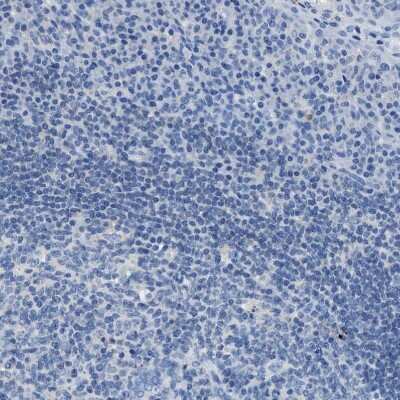 Immunohistochemistry-Paraffin: Nebulin Antibody [NBP1-87752]