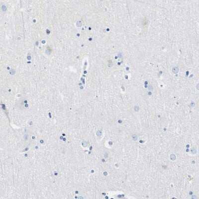 Immunohistochemistry-Paraffin: Nebulin Antibody [NBP1-87752]