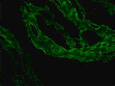 Immunohistochemistry: Nebulin Antibody (NB2) [NB120-11099]