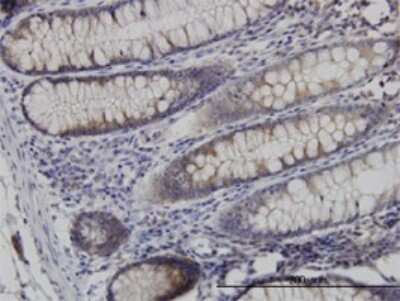 Immunohistochemistry-Paraffin: Necdin Antibody (1B3) [H00004692-M02]