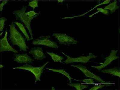 Immunocytochemistry/ Immunofluorescence: Necdin Antibody (3B9) [H00004692-M05]