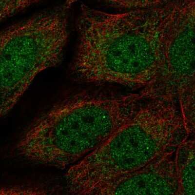 Immunocytochemistry/ Immunofluorescence: Necdin Antibody [NBP2-57334]