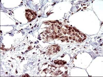 Immunohistochemistry: Necdin Antibody (OTI5D1) [NBP2-46117]